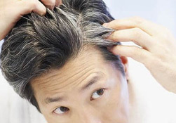 علل و راه های درمان ریزش مو